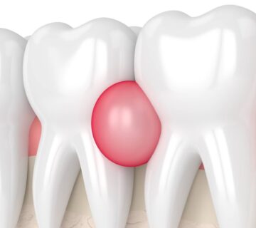 ماساژ لثه و دندان با روغن طبیعی
